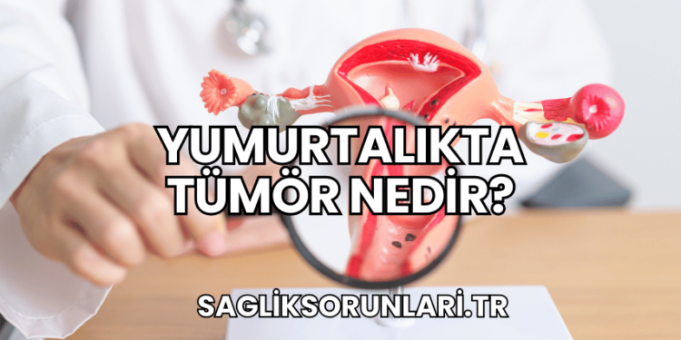 Yumurtalıkta Tümör Nedir?