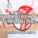 Yumurtalıkta Tümör Nedir?