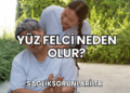 Yüz Felci Neden Olur?