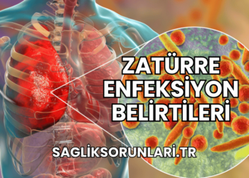 Zatürre Enfeksiyon Belirtileri