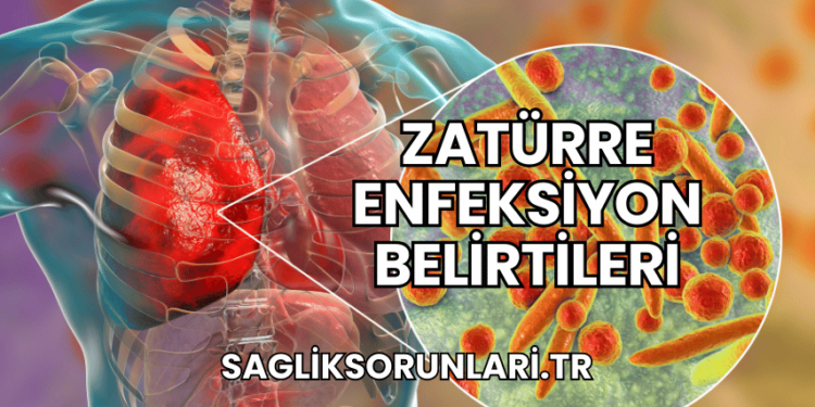 Zatürre Enfeksiyon Belirtileri