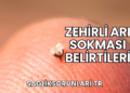 Zehirli Arı Sokması Belirtileri