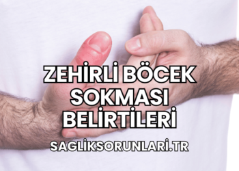 Zehirli Böcek Sokması Belirtileri