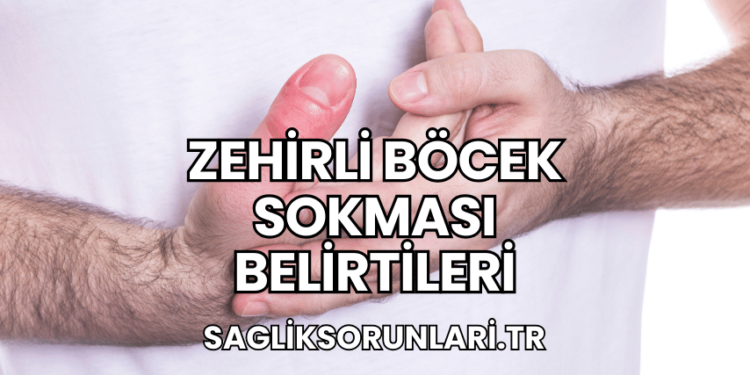 Zehirli Böcek Sokması Belirtileri