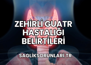 Zehirli Guatr Hastalığı Belirtileri