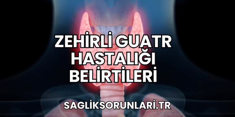 Zehirli Guatr Hastalığı Belirtileri