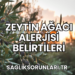 Zeytin Ağacı Alerjisi Belirtileri