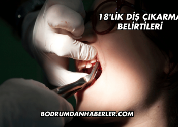 18'lik Diş Çıkarma Belirtileri
