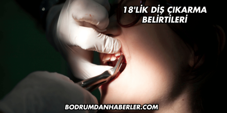 18'lik Diş Çıkarma Belirtileri