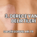 3. Derece Yanık Belirtileri