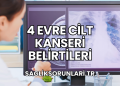 4 Evre Cilt Kanseri Belirtileri