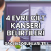 4 Evre Cilt Kanseri Belirtileri