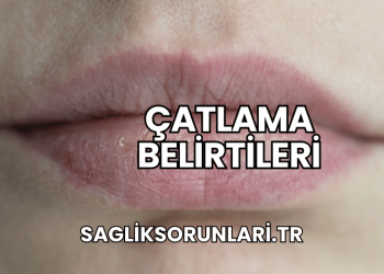 Çatlama Belirtileri