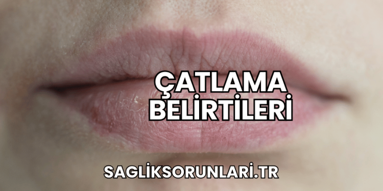 Çatlama Belirtileri