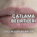 Çatlama Belirtileri