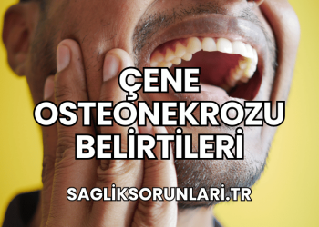 Çene Osteonekrozu Belirtileri