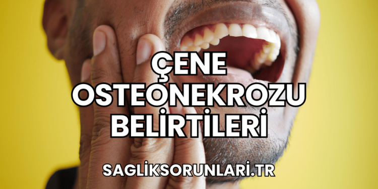 Çene Osteonekrozu Belirtileri