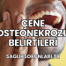 Çene Osteonekrozu Belirtileri