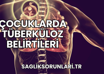 Çocuklarda Tüberküloz Belirtileri