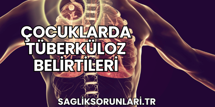 Çocuklarda Tüberküloz Belirtileri