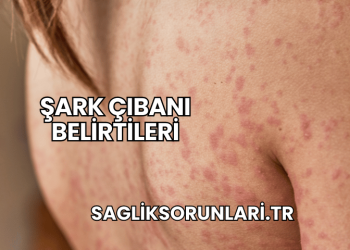 Şark Çıbanı Belirtileri