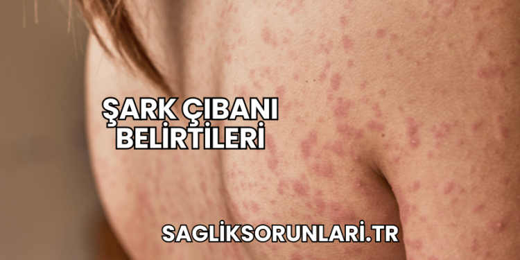 Şark Çıbanı Belirtileri