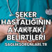 Şeker Hastalığının Ayaktaki Belirtileri