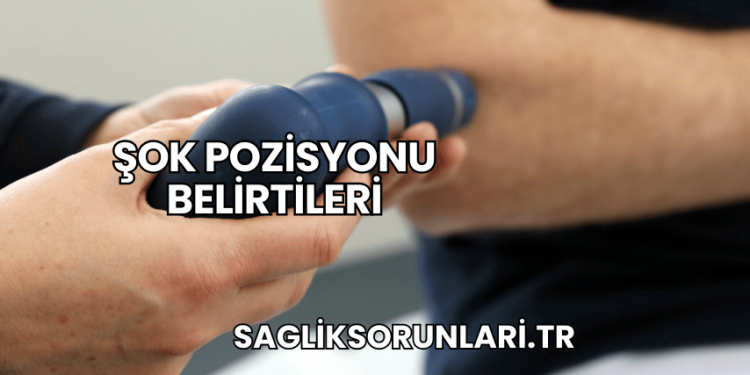 Şok Pozisyonu Belirtileri