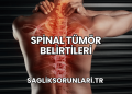 Spinal Tümör Belirtileri