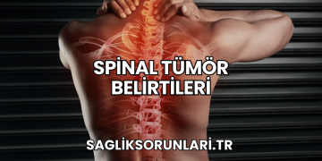 Spinal Tümör Belirtileri