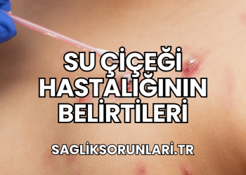 Su Çiçeği Hastalığının Belirtileri
