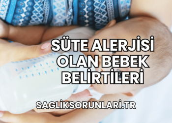 Süte Alerjisi Olan Bebek Belirtileri