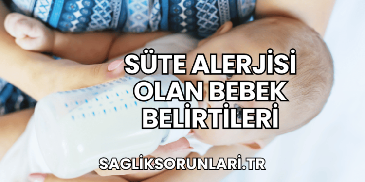 Süte Alerjisi Olan Bebek Belirtileri