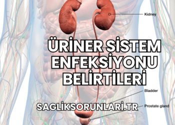Üriner Sistem Enfeksiyonu Belirtileri