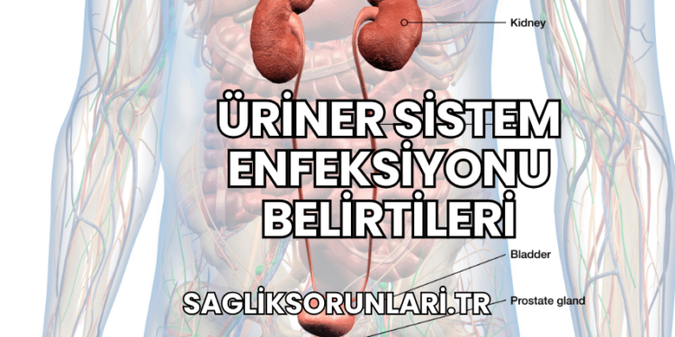 Üriner Sistem Enfeksiyonu Belirtileri