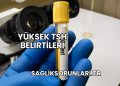 Yüksek TSH Belirtileri