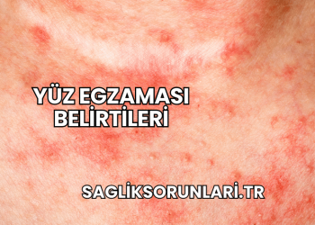 Yüz Egzaması Belirtileri