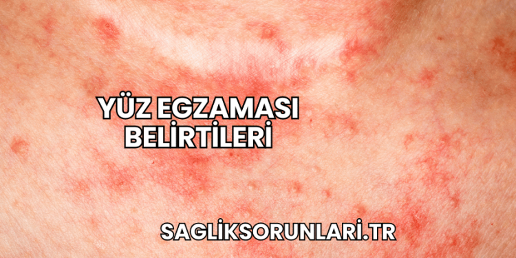 Yüz Egzaması Belirtileri
