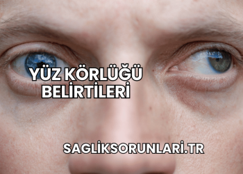 Yüz Körlüğü Belirtileri