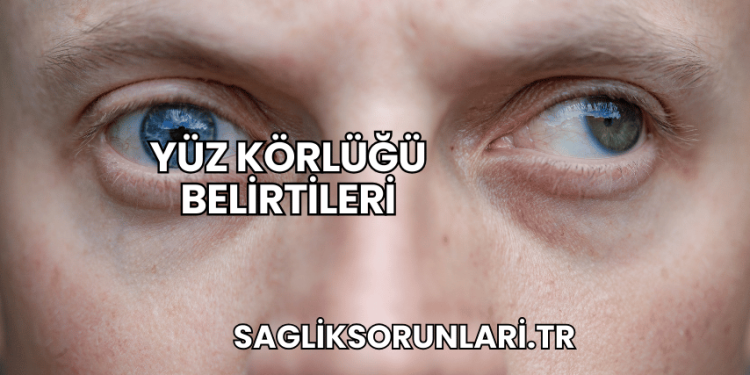 Yüz Körlüğü Belirtileri