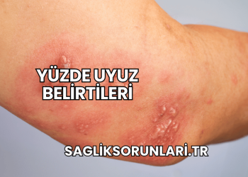 Yüzde Uyuz Belirtileri
