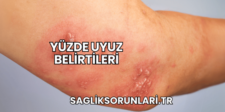 Yüzde Uyuz Belirtileri