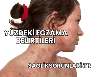 Yüzdeki Egzama Belirtileri
