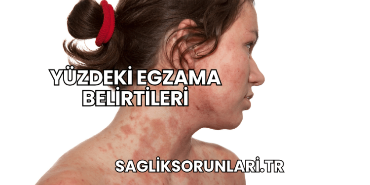 Yüzdeki Egzama Belirtileri