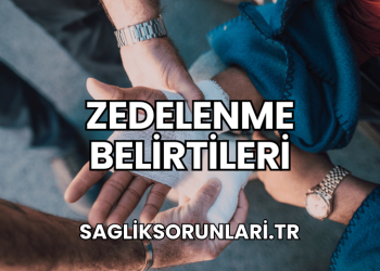 Zedelenme belirtileri