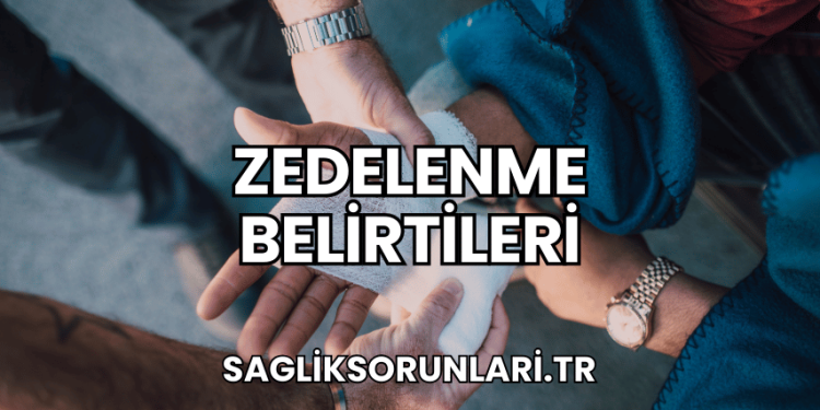 Zedelenme belirtileri
