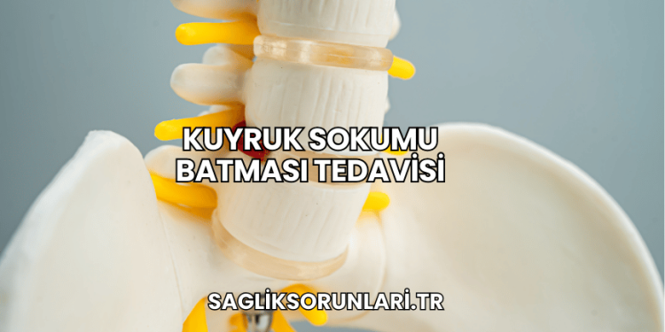 Kuyruk Sokumu Batması Tedavisi