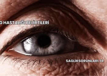 MG Hastalığı Belirtileri