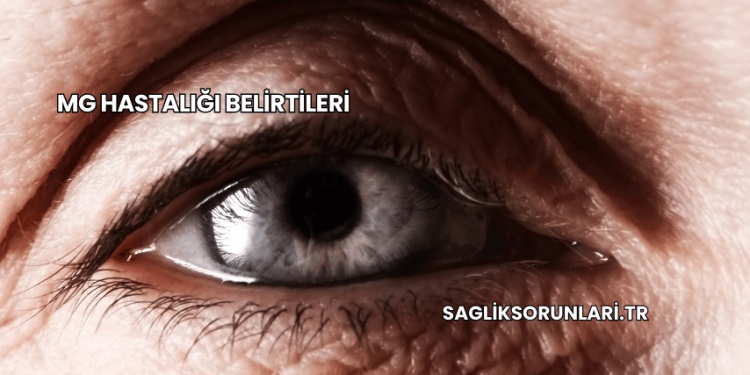 MG Hastalığı Belirtileri