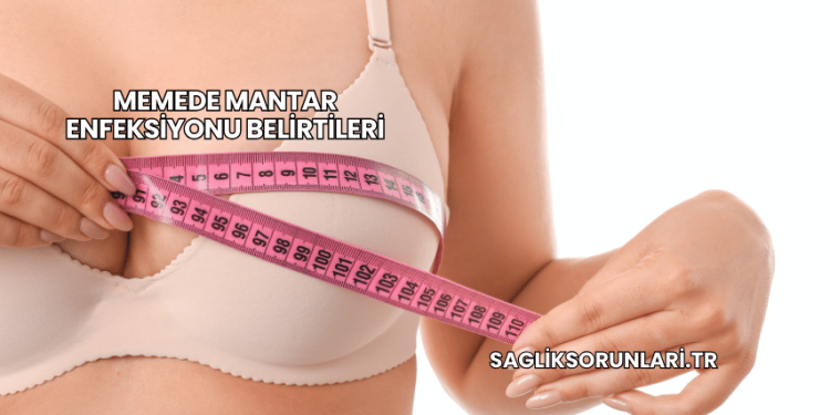 Memede Mantar Enfeksiyonu Belirtileri